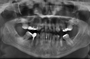 Zdjęcia rtg zlecane zbyt często? (foto: pixabay) Dentyści zbyt często zlecają zdjęcia rtg