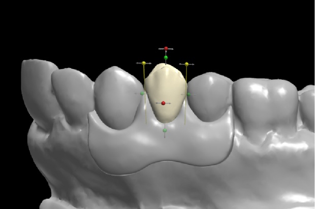 Nowa generacja drukarek dla dentystów Przełom w drukarkach 3D dla stomatologii?