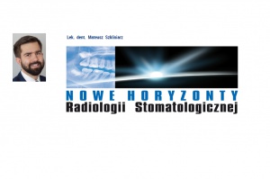 lek. dent. Mateusz Szkliniarz Wykorzystanie CBCT w endodoncji