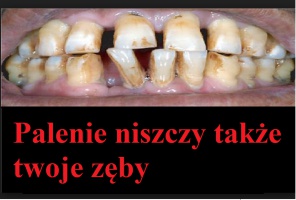 Palenie niszczy zęby Na palaczy wyszczerzać będą zepsute zęby