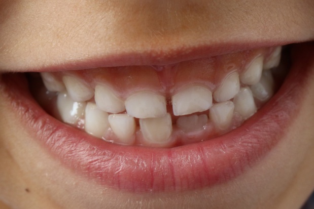 Stomatologia dziecięca (foto: pixabay) Ilu dentystów leczy dzieci