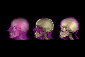 Zwrot na inwestycji, magiczne słowo? Radiologia: zwrot na inwestycji, magiczne słowo?