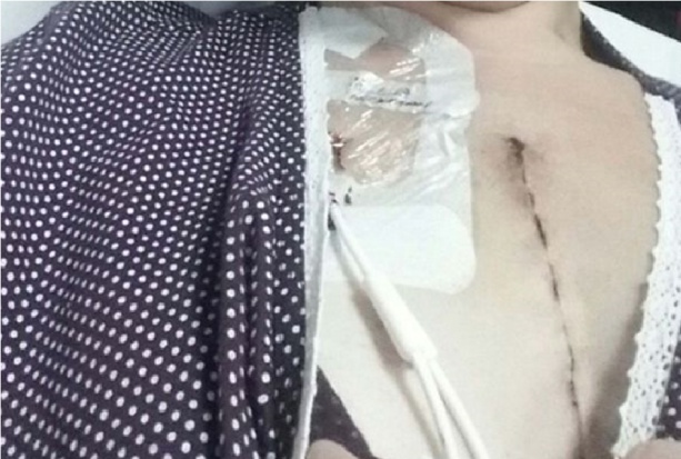 Helen Bolton po operacji Czekała na dentystę niemal dwa lata i niemal umarła