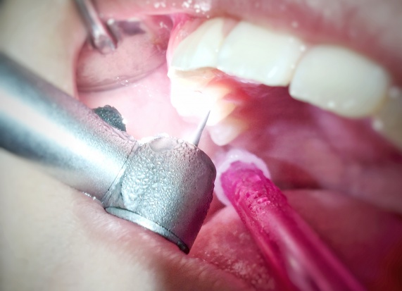 W Karsinie miała miejsce wspólna akcja gminy i lokalnego stomatologa (fot. pixabay) Karsin: gimnazjaliści za darmo u dentysty
