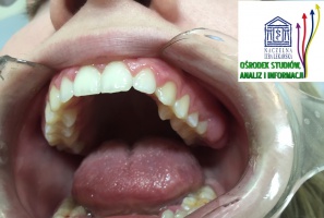 „Lekarze Stomatolodzy 2016” Dentystów portret własny: coraz wyższe wymagania wobec funkcjonujących w biznesie