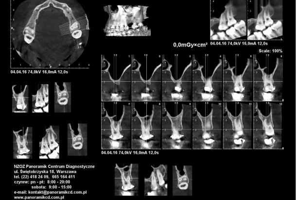 Analiza CBCT, jak z niej korzystać Rozszyfrowanie tajemnicy CBCT