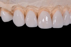 Praca dla technika dentystycznego (foto: pixabay) Czy technicy dentystyczni mogą liczyć na zatrudnienie?