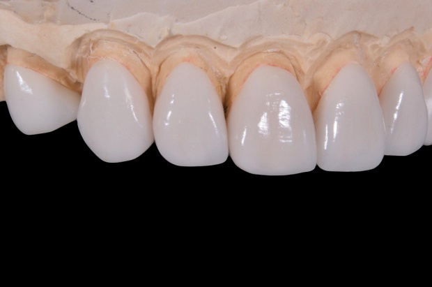 Praca dla technika dentystycznego (foto: pixabay) Czy technicy dentystyczni mogą liczyć na zatrudnienie?