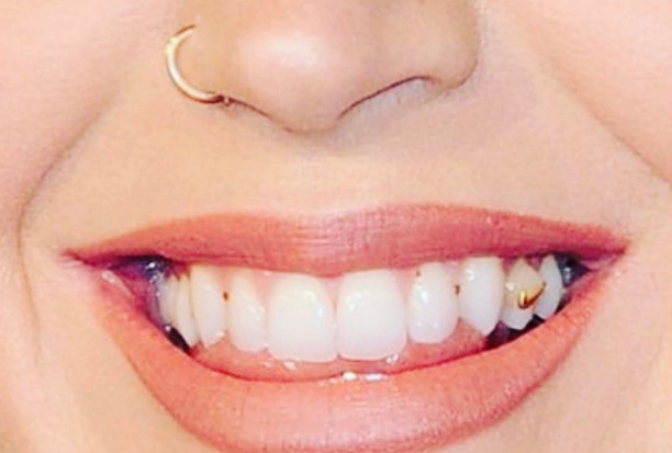 Oryginalna biżuteria nazębna Kate Perry (fot. Instagram) Katy Perry: zęby nie zawsze perfekcyjne
