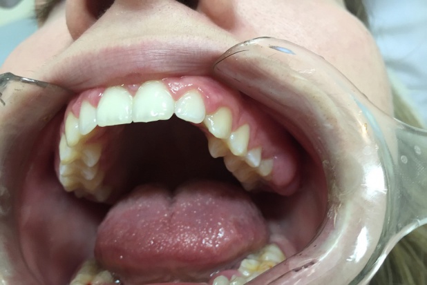 Zatrudnianie dentysty przez dentystę Kolejne formy zatrudnienia, w ramach indywidualnej praktyki, to erzac?