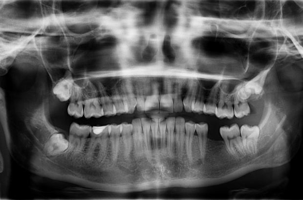 Kto może opisywać zdjęcia rtg (foto: pixabay) Zezwólcie dentystom opisywać zdjęcia rtg