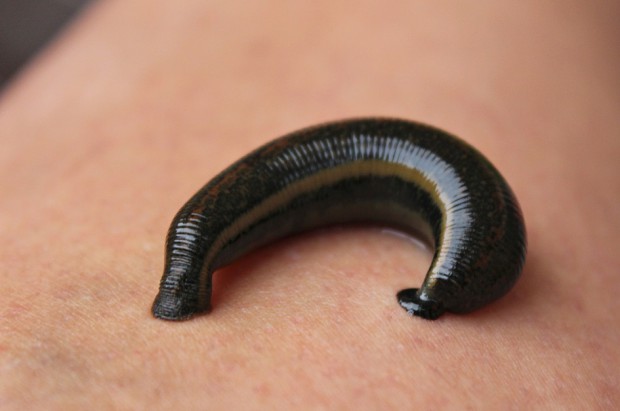 Hirudoterapia w gabinecie stomatologicznym wspomaga leczenie farmakologiczne (fot. pixabay) Pijawki u dentysty