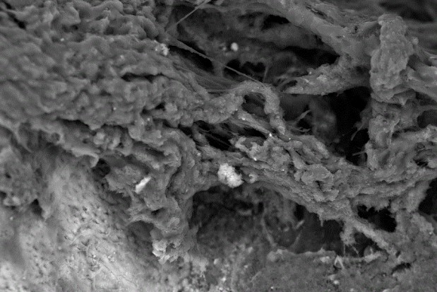 Biofilm Streptococcus mutans na hydroksyapatycie (fot. Adam Junka) Wrocław: naukowcy testują inteligentny lek na infekcje kości
