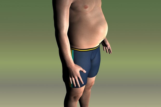 Związki otyłości i zdrowia jamy ustnej będą dyskutowane na kongresie FDI w Madrycie (fot. pixabay) Choroby jamy ustnej a zespół metaboliczny i otyłość na kongresie FDI w Madrycie