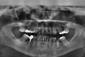Sanepid nakłada nadmierne obowiązki (foto: pixabay) Gabinet dentystyczny to nie pracownia rentgenowska!