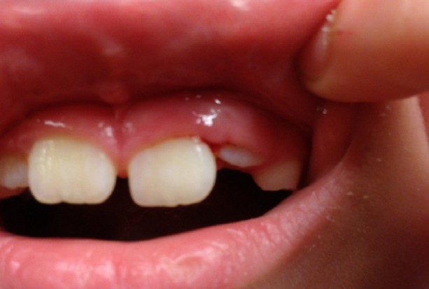 W MZ o stomatologii dziecięcej (foto: pixabay) Będą koordynatorzy ds. opieki stomatologicznej dzieci i młodzieży?