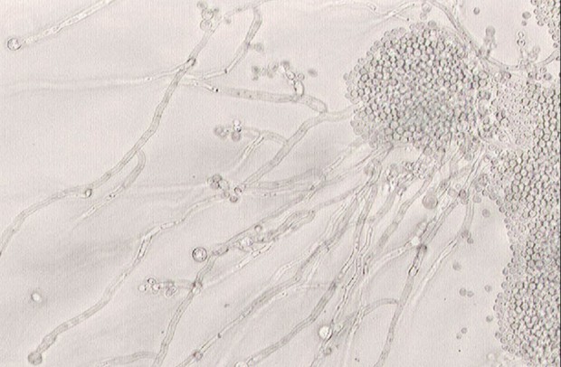 Candida albicans przyczynia się do rozwoju próchnicy szczególnie u osób jedzących dużo słodkich pokarmów (fot. Wikipedia) Naukowcy: otwórzmy drugi front walki z próchnicą