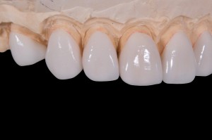 Dentysta Misza Wykow chwali sobie pracę w Polsce (foto: pixabay) Polska to dobry kraj dla dentystów?