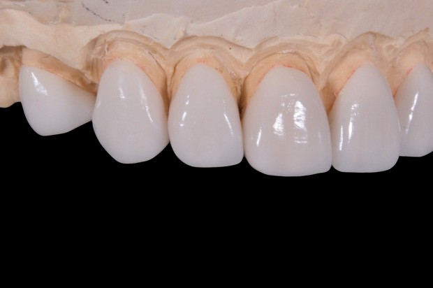 Dentysta Misza Wykow chwali sobie pracę w Polsce (foto: pixabay) Polska to dobry kraj dla dentystów?