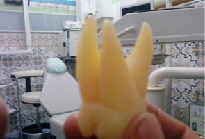 WUM: dyplomy absolwentów - techniki dentystyczne (foto: flickr) WUM: dyplomy na kierunku techniki dentystyczne