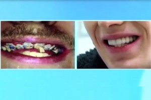 Jay przed i po metamorfozie Gość, który nie mył zębów przez całe życie