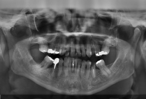 Stomatologia: Konkurs na pracownika w UM w Lublinie (foto: pixabay) UM w Lublinie radiologia stomatologiczna: poszukiwany asystent