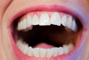 Medicover celuje w uśmiech (foto: pixabay) „Obrazowanie uśmiechu” w Medicover