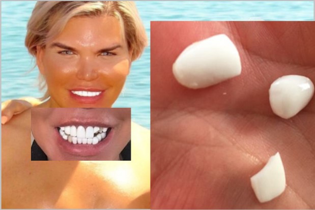 Problemy z zębami Rodrigo Alvesa Rodrigo Alves miał za ładne zęby
