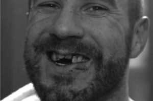 Cesaro (Claudio Castagnoli) tuż po urazie przednich zębów (fot. Instagram) Pytanie na Instagramie: szukam dobrego dentysty