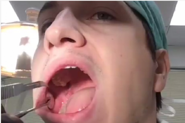 Yakhyaev zrobił to sam w lusterku Dentysto wylecz się sam