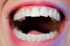 Uśmiech "stomatologiczny" (fot. pixabay) Dzisiaj Światowy Dzień Uśmiechu: śmiejmy się na zdrowie!