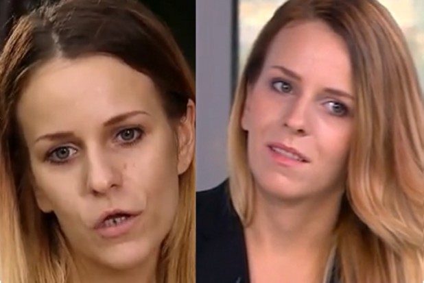 Beata Biedrzycka przed i po metamorfozie Bardzo długa lista chętnych na restytucję zdewastowanego uzębienia