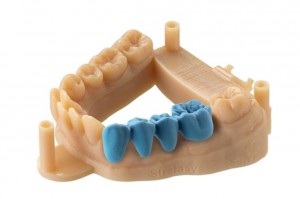 Drukowanie w stomatologii Pomorskie Dni Druku 3D – MED