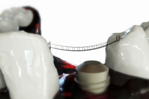 Implanty w sądzie (foto: pixabay) Duże komplikacje po wszczepieniu implantów, ale bez winy dentystki