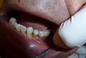Więcej w koszyku świadczeń stomatologicznych (foto: pixabay) Wzrasta koszyk gwarantowanych usług stomatologicznych