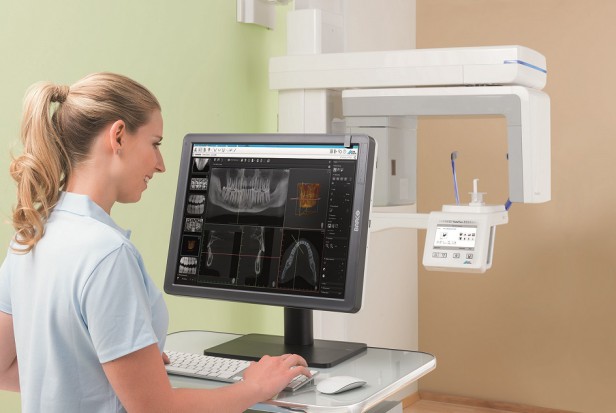 Nowy sprzęt w UM w Lublinie (foto: DÜRR DENTAL) Stomatologiczne Centrum Kliniczne UM w Lublinie ma tomograf stożkowy 3D