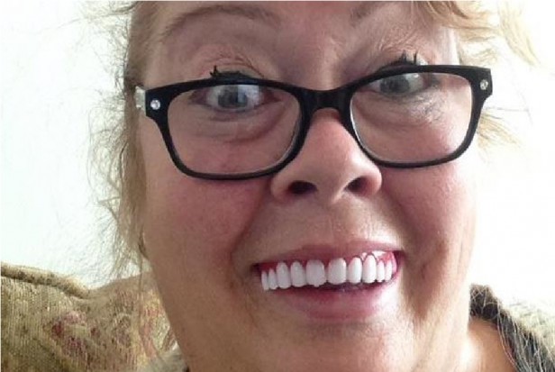 Sue Robertson z przyklejonym Perfect Smile Veneer (foto: pixabay) Olśniewający uśmiech na gorącą wodę