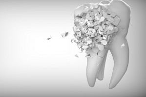 Stomatologia w statystyce (foto: pixabay) GUS: trendy w stomatologii