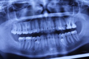 Konkurs ofert na diagnostykę RTG w Zakładzie Karnym w Jastrzębiu Zdroju (fot. pixabay) Jest przetarg na wykonywanie zdjęć RTG za całe... 500 zł