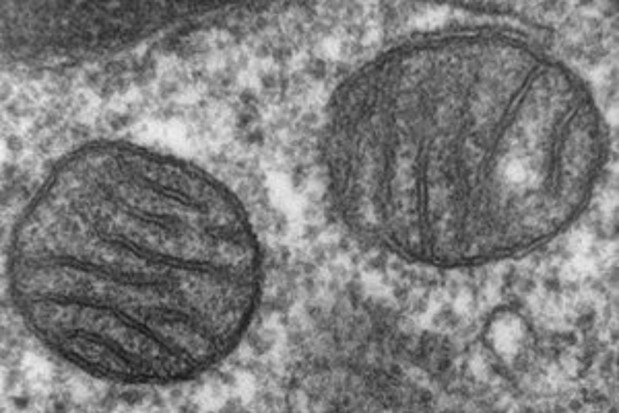 Mitochondria - komórkowe elektrownie (fot. Wikipedia) Zdrowie dziąseł zaczyna się w mitochondriach
