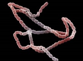 Łańcuch komórek bakterii Streptococcus sp., uznawanej za główną przyczynę próchnicy zębów (fot. Wikipedia) Bakterie, fosfor i próchnica