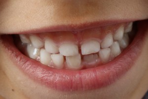 Doroczne spotkanie ekspertów z dziedziny stomatologii dziecięcej (fot. pixabay) Konferencja PASD wyznaczona głośnymi nazwiskami