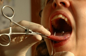 Skutki stomatologiczne piercingu coraz lepiej poznane (fot. Wikipedia) Kolejne badania: piercing groźny dla dziąseł i zębów