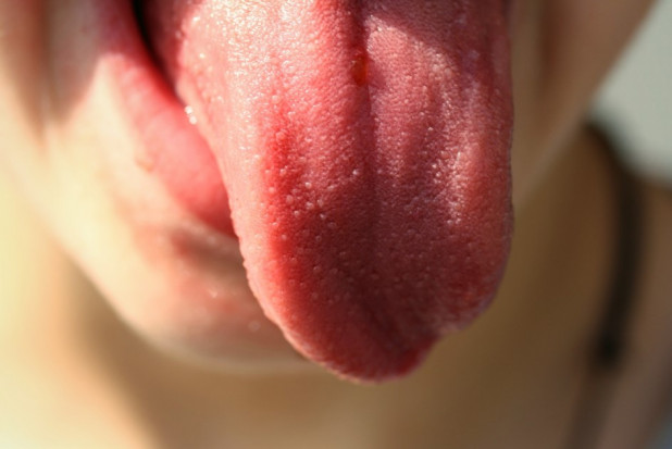 Język w niebezpieczeństwie (foto: pixabay) Seplenienie po wizycie u dentysty