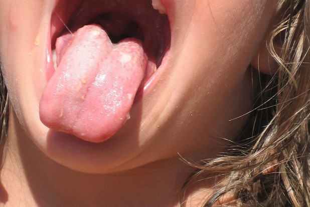 U dentystki język w niebezpieczeństwie (foto: pixabay) 25 tys. zł zapłaci dentystka za uszkodzony nerw trójdzielny