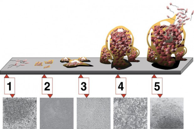 Powstawanie biofilmu 1. początkowe przywiązanie; 2. nieodwracalne przywiązanie; 3. dojrzewanie I; 4. dojrzewanie II; 5. rozproszenie. (fot. Wikipedia) Biofilm rozbrojony