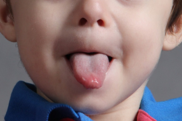 Dentystka pomogła chłopcu zacząć mówić (foto: pixabay) Dentystka