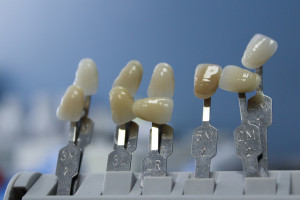 Technik dentystyczny potrzebny do pracy w GUMed (fot. pixabay) GUMed: wolny etat instruktora technik dentystycznych