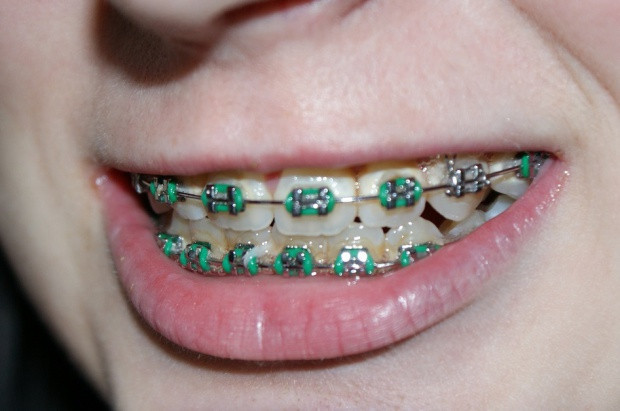 Kłopoty - gdy dentyście brakuje umiejętności (fot. pixabay) Dentystka bez specjalizacji podjęła się leczenia ortodontycznego, teraz musi zapłacić