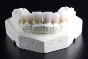 Pytanie o zawód technika dentystycznego (foto: pixabay) Technik dentystyczny – przedmiotem sporu